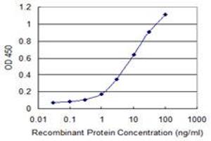 Detection limit for recombinant GST tagged RAB7B is 0. (RAB7B anticorps  (AA 100-199))