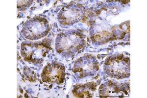IHC analysis of RPL36 using anti-RPL36 antibody (ABIN7602917). (RPL36 anticorps  (C-Term))