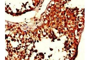 Immunohistochemistry of paraffin-embedded human testis tissue using ABIN7169181 at dilution of 1:100 (SIK1 anticorps  (AA 492-750))
