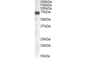 Image no. 1 for anti-Zinc Finger, DHHC-Type Containing 13 (ZDHHC13) (C-Term) antibody (ABIN374518) (ZDHHC13 anticorps  (C-Term))