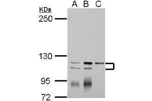 WB Image Sample (30 ug of whole cell lysate) A: Jurkat B: Raji C: K562 5% SDS PAGE antibody diluted at 1:2000 (ATP2A3 anticorps  (N-Term))