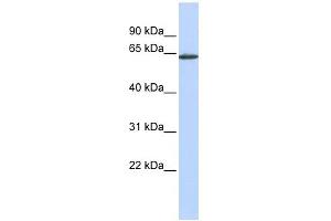 ANTXR1 antibody used at 1 ug/ml to detect target protein. (ANTXR1 anticorps  (Middle Region))