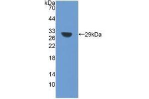 Western blot analysis of the recombinant protein. (SIRT1 anticorps  (AA 238-482))