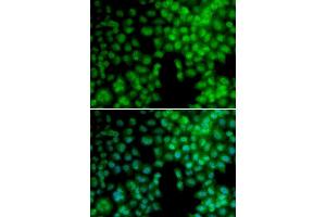 Immunofluorescence analysis of A549 cell using VDR antibody.
