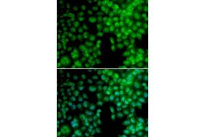 Immunofluorescence analysis of A549 cell using VDR antibody. (Vitamin D Receptor anticorps  (AA 1-300))