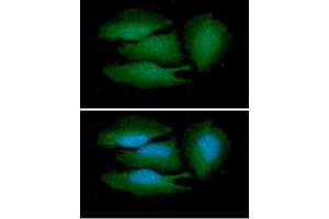 ICC/IF analysis of BRCC36 in HeLa cells line, stained with DAPI (Blue) for nucleus staining and monoclonal anti-human BRCC36 antibody (1:100) with goat anti-mouse IgG-Alexa fluor 488 conjugate (Green).