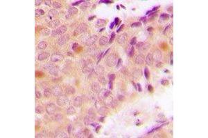 Immunohistochemistry (IHC) image for anti-Poly(rC) Binding Protein 2 (PCBP2) antibody (ABIN7308138)