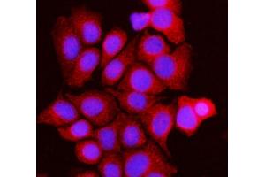 IF analysis of BCKDK using anti-BCKDK antibody (ABIN7601470). (BCKDK anticorps  (AA 36-316))