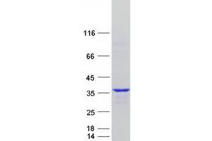 Cyclin Y (CCNY) (Transcript Variant 2) protein (Myc-DYKDDDDK Tag)
