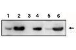 anti-PIG3 (p53 Inducible Gene 3) (full length) antibody