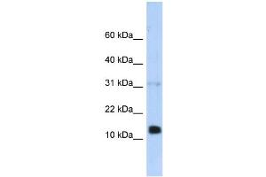 WB Suggested Anti-REG1B Antibody Titration:  0. (REG1B anticorps  (N-Term))