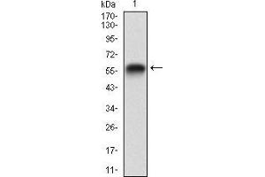 Western blot analysis using RAP1GAP mAb against human RAP1GAP (AA: 412-678) recombinant protein. (RAP1GAP anticorps  (AA 412-678))