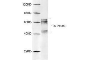 Image no. 1 for anti-Microtubule-Associated Protein tau (MAPT) (Thr217) antibody (ABIN2625197)