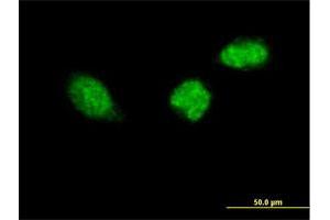 Immunofluorescence of purified MaxPab antibody to ZWINT on HeLa cell.