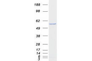 Validation with Western Blot