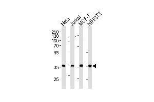 N Antibody (ABIN1882271 and ABIN2843406) western blot analysis in Hela,Jurkat,MCF-7,mouse NIH/3T3 cell line lysates (35 μg/lane). (NPM1 anticorps)