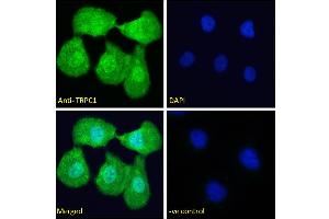 ABIN6391351 Immunofluorescence analysis of paraformaldehyde fixed U2OS cells, permeabilized with 0. (TRPC1 anticorps  (Internal Region))