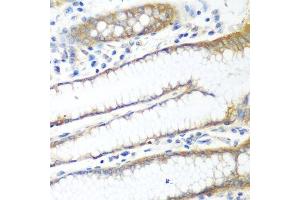 Immunohistochemistry of paraffin-embedded human stomach using PPP4R1 antibody. (PPP4R1 anticorps  (AA 324-647))