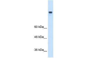 WB Suggested Anti-MTTP Antibody Titration:  0. (MTTP anticorps  (N-Term))