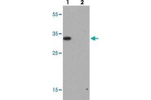 Western blot analysis of RILP in A-20 cell lysate with RILP polyclonal antibody  at 1 ug/mL. (RILP anticorps  (Internal Region))