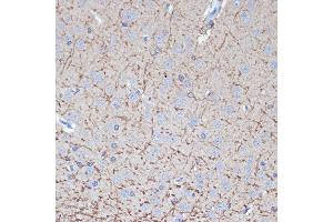 Immunohistochemistry of paraffin-embedded rat brain using TMOD2 Rabbit mAb (ABIN7271011) at dilution of 1:100 (40x lens).