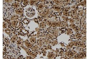 ABIN6277780 at 1/100 staining Rat kidney tissue by IHC-P. (PKC epsilon anticorps  (pSer729))