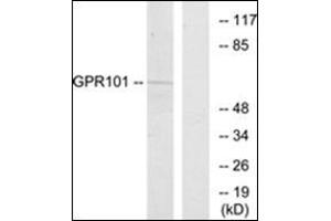 Western blot analysis of extracts from COS7 cells, using GPR101 Antibody. (GPR101 anticorps  (C-Term))
