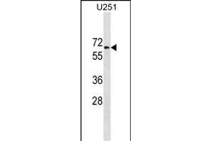 GGT1 Antibody (N-term) (ABIN1881373 and ABIN2838799) western blot analysis in  cell line lysates (35 μg/lane). (GGT1 anticorps  (N-Term))