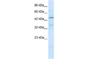 WB Suggested Anti-ZNF358 Antibody Titration:  1. (ZNF358 anticorps  (N-Term))
