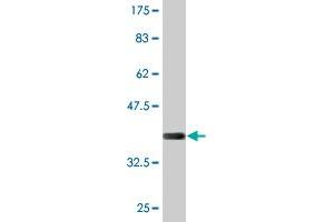 Western Blot detection against Immunogen (37.