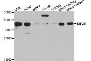 Western blot analysis of extracts of various cell lines, using EIF2S1 antibody. (EIF2S1 anticorps)