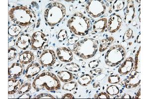 Immunohistochemical staining of paraffin-embedded Human Kidney tissue using anti-KHK mouse monoclonal antibody. (Ketohexokinase anticorps)