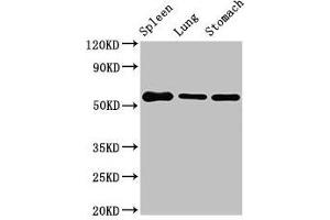 Western Blot Positive WB detected in: Mouse spleen tissue, Mouse lung tissue, Mouse stomach tissue All lanes: Glp1r antibody at 3 μg/mL Secondary Goat polyclonal to rabbit IgG at 1/50000 dilution Predicted band size: 54 kDa Observed band size: 54 kDa (GLP1R anticorps  (AA 22-145))