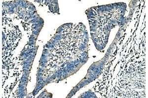 IHC analysis of Ankyrin Erythroid/ANK/ANK1 using anti-Ankyrin Erythroid/ANK/ANK1 antibody (ABIN7599959).