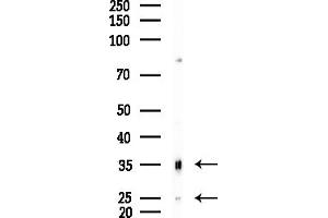 Western blot analysis of lysates from Mouse testis, using CBR1 Antibody at 1/1000 dilution.