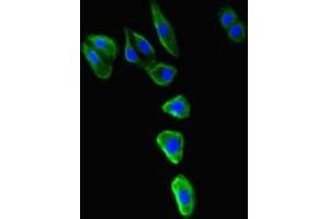 Immunofluorescence analysis of HepG2 cells, using MR1 antibody (1/100 dilution) and AF488-conjugated Goat anti-Rabbit IgG (H+L) secondary antibody. (MR1 anticorps  (AA 150-253))