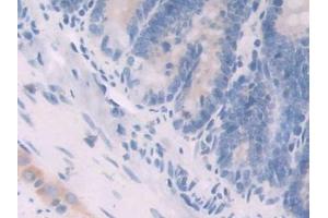IHC-P analysis of Rat Small intestine Tissue, with DAB staining. (Neuregulin 1 anticorps  (AA 328-486))