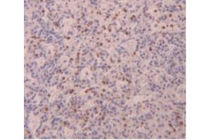 IHC-P analysis of Human Spleen Tissue, with DAB staining. (FLG2 anticorps  (AA 1222-1368))