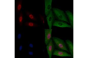 ABIN6256914 and ABIN6274189 staining  cells by IF/ICC. (ATF3 anticorps  (C-Term))