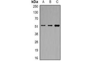 Western blot analysis of eIF3E expression in MCF7 (A), K562 (B), HepG2 (C) whole cell lysates.