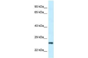 Western Blot showing RPS9 antibody used at a concentration of 1 ug/ml against Hela Cell Lysate (RPS9 anticorps  (N-Term))