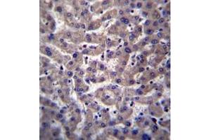 Formalin fixed and paraffin embedded human liver tissue reacted with ZADH1 Antibody (N-term) followed by peroxidase conjugation of the secondary antibody and DAB staining (PTGR2 anticorps  (N-Term))