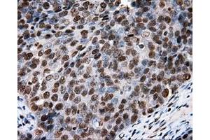 Immunohistochemical staining of paraffin-embedded colon tissue using anti-RC204952 mouse monoclonal antibody. (XRCC1 anticorps)