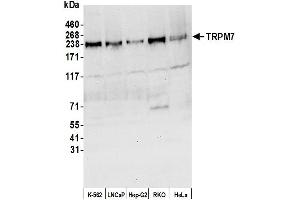 Western Blotting (WB) image for anti-Transient Receptor Potential Cation Channel, Subfamily M, Member 7 (TRPM7) (AA 1815-1865) antibody (ABIN7450962)