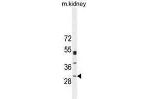 CF062 Antibody (Center) western blot analysis in mouse kidney tissue lysates (35µg/lane). (C6ORF62 anticorps  (Middle Region))