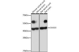 Western blot analysis of extracts of various cell lines, using CHX10 Rabbit mAb (ABIN7271331) at 1:1000 dilution. (VSX2 anticorps)