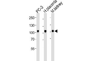 Western blot analysis of lysates from PC-3 cell line, human placenta, mouse kidney tissue lysate (from left to right), using Ephb4 Antibody (C-term) (ABIN6243858 and ABIN6577663). (EPH Receptor B4 anticorps  (C-Term))