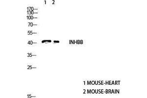 Western Blot (WB) analysis of Mouse Heart and Mouse Brain using Inhibin beta-B antibody. (INHBB anticorps  (C-Term))