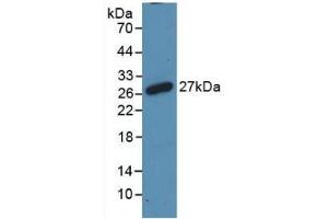 Detection of Recombinant RANk, Rat using Polyclonal Antibody to Receptor Activator Of Nuclear Factor Kappa B (RANk) (TNFRSF11A anticorps  (AA 31-214))