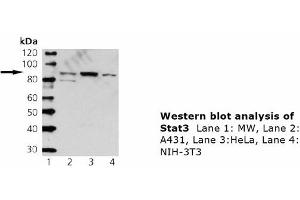 Image no. 1 for anti-Signal Transducer and Activator of Transcription 3 (Acute-Phase Response Factor) (STAT3) antibody (ABIN331480) (STAT3 anticorps)